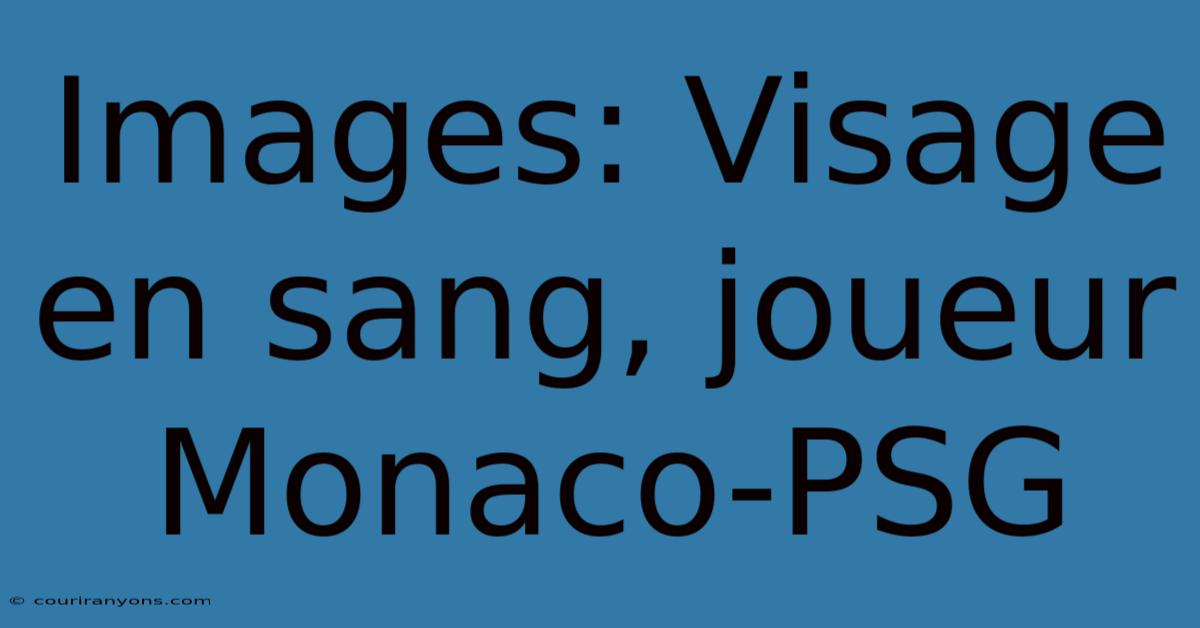 Images: Visage En Sang, Joueur Monaco-PSG